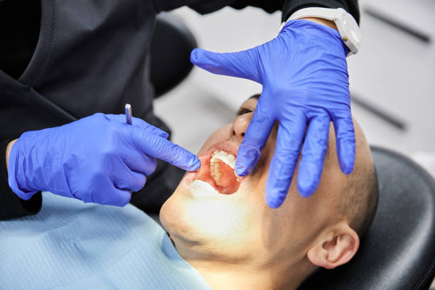 Best Emergency Treatment for Dental Infections or Abscesses in Astatula, FL